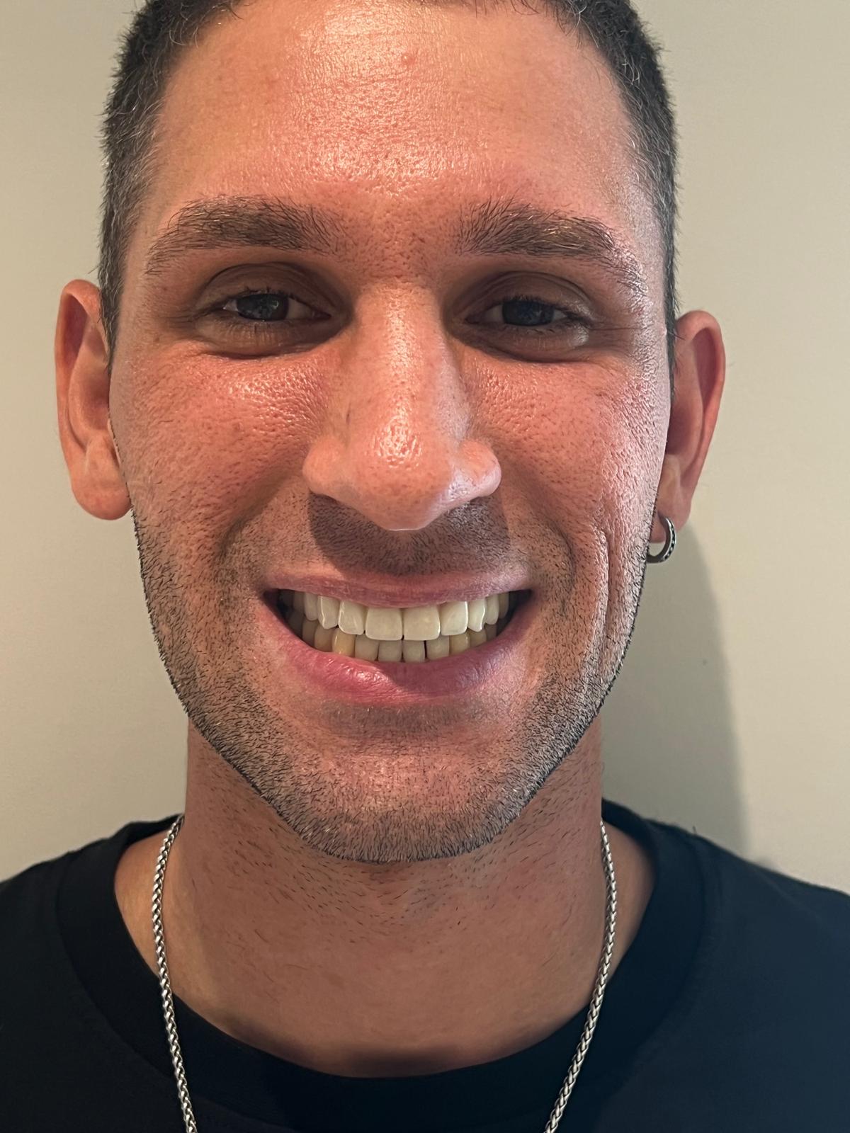 ECE Dental Patient Transformation